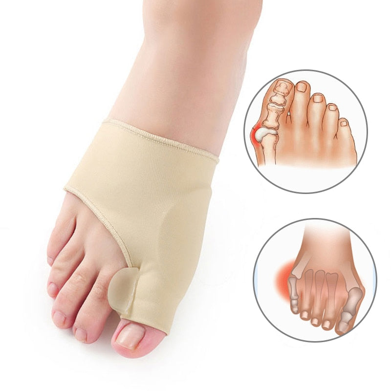Orthotics for Hallux Valgus
