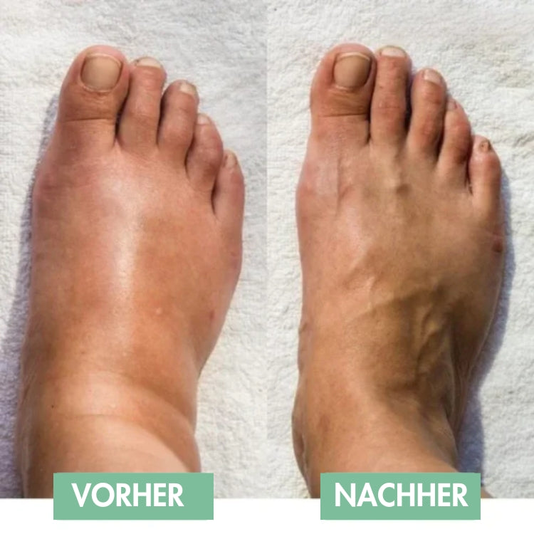 Appareil de massage des pieds EMS pour soulagement immédiat