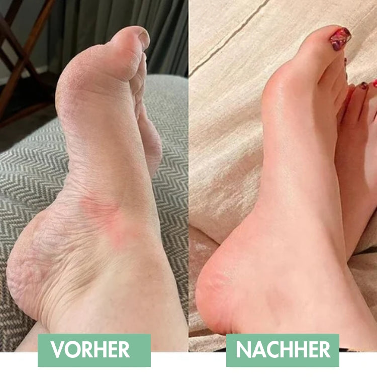 Appareil de massage des pieds EMS pour soulagement immédiat