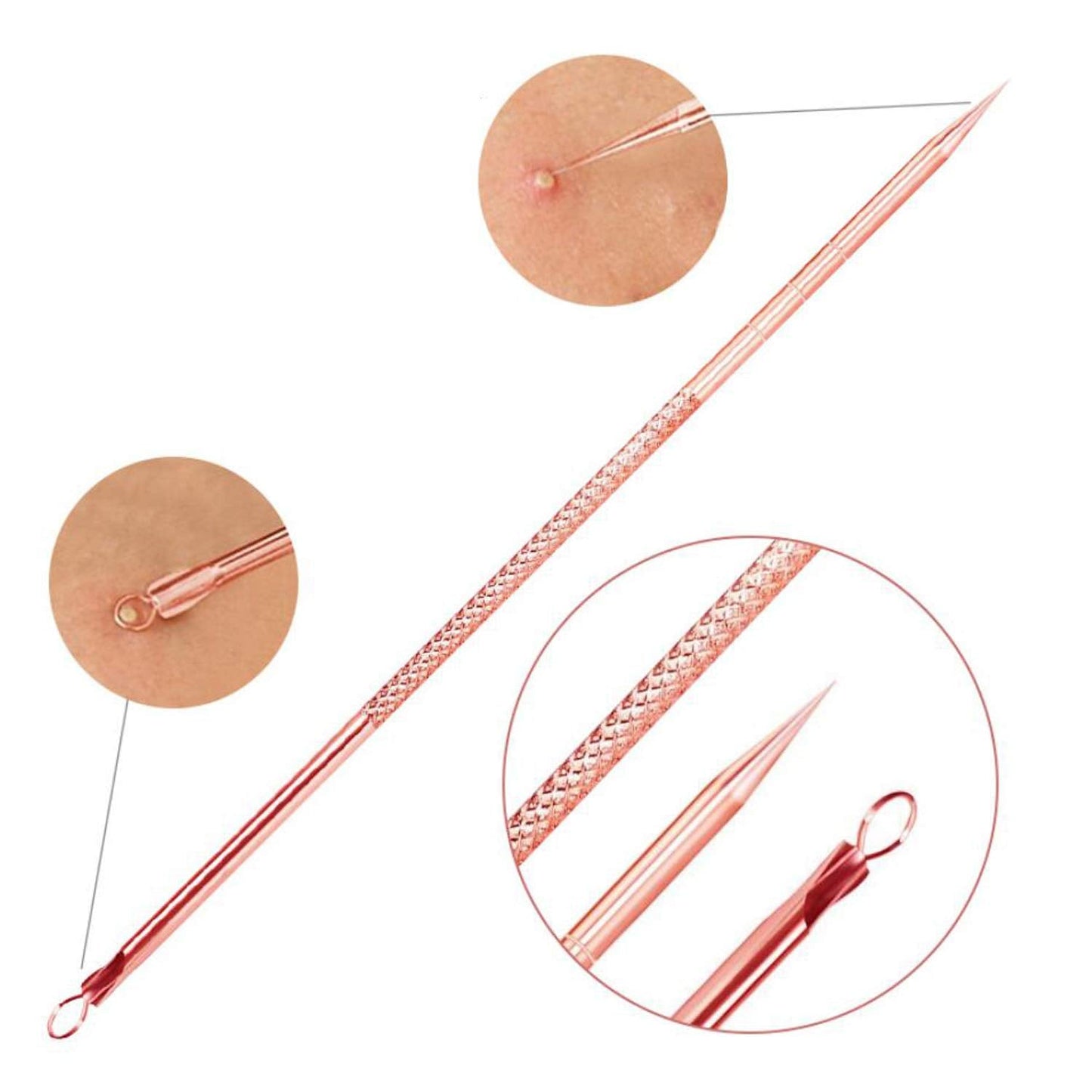 Blackhead & Pimple Extractor Kit