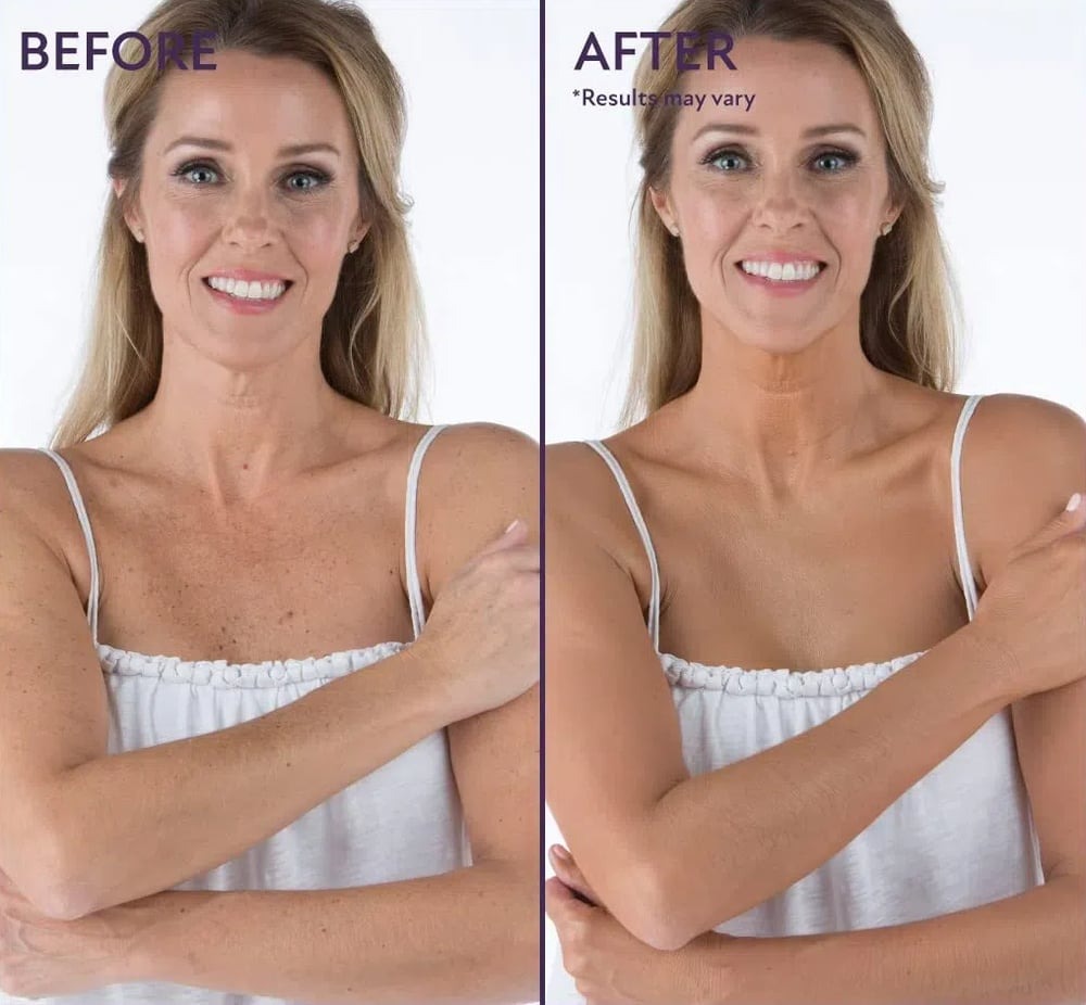 Body Coverage Perfector