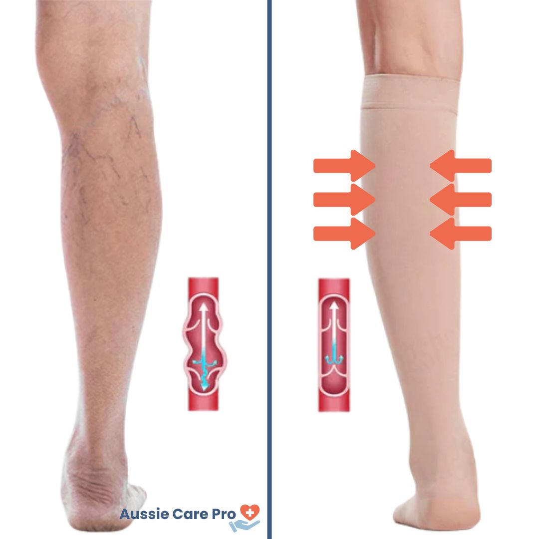 Chaussettes de compression graduelle à bout ouvert pour le soutien de la circulation sanguine