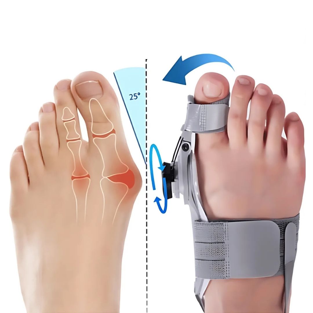 Correcteur d'hallux valgus à soutiens ajustables