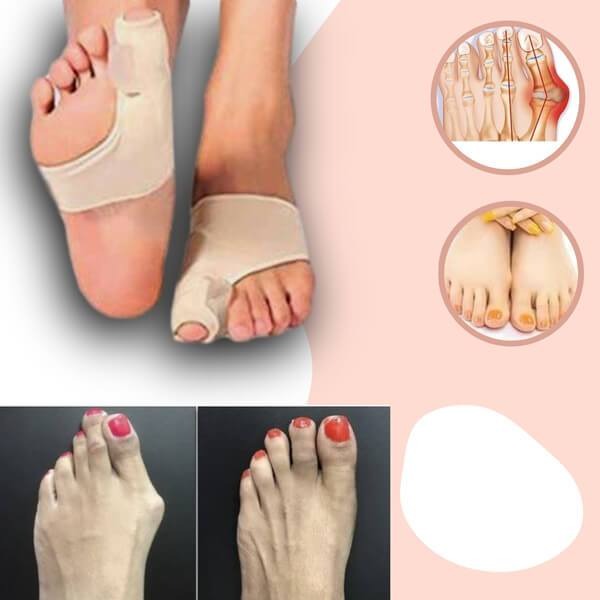 Correcteur d'hallux valgus (oignon) et soulagement de la douleur
