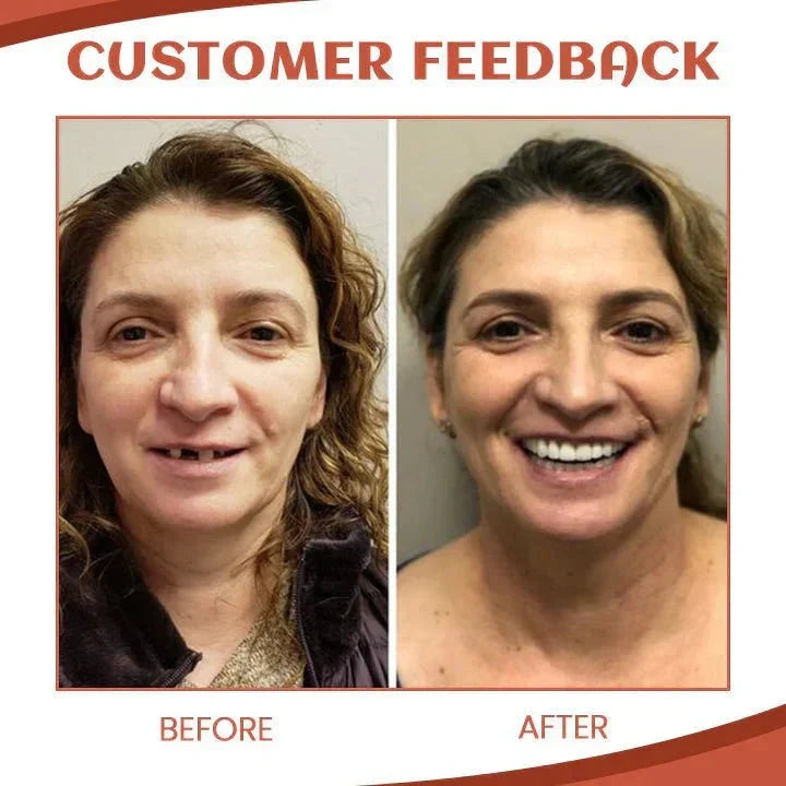 Ensemble de fausses dents en silicone ajustable pour un sourire naturel