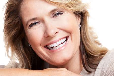 Facettes dentaires – Ajustement naturel et confort