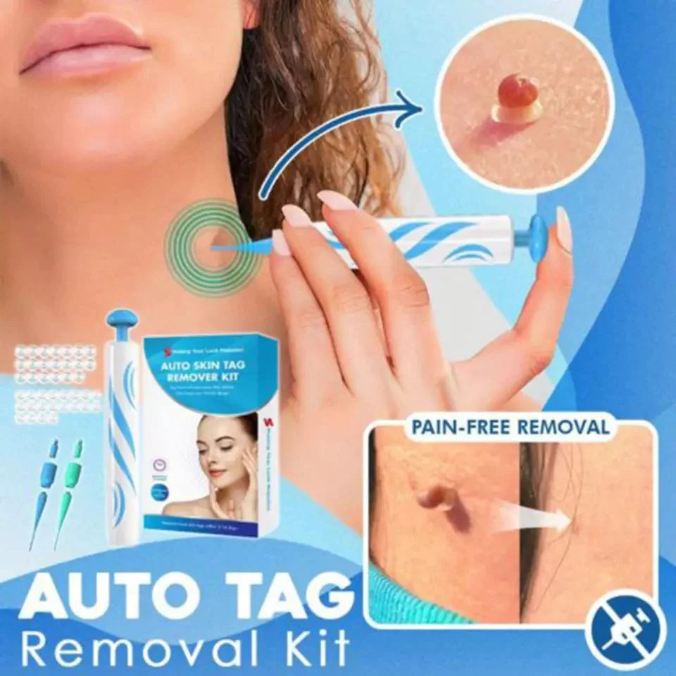 Kit d'applicateur automatique d'élastiques pour l'élimination des acrochordons