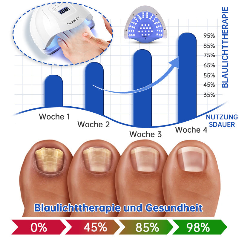 NailCure™ - Nail Fungus Laser Treatment Solution (50% DISCOUNT)