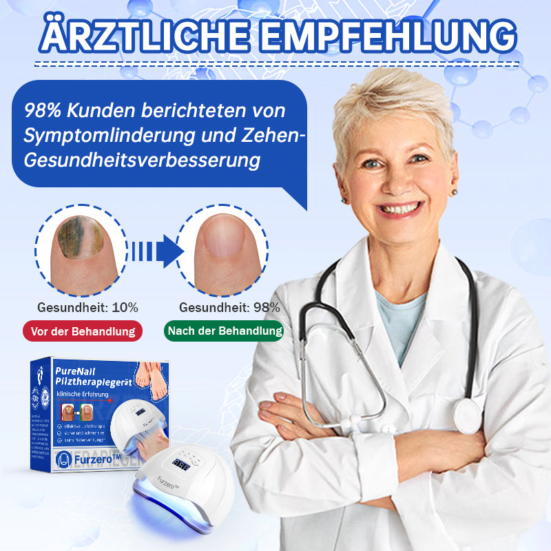 NailCure™ - Nail Fungus Laser Treatment Solution (50% DISCOUNT)