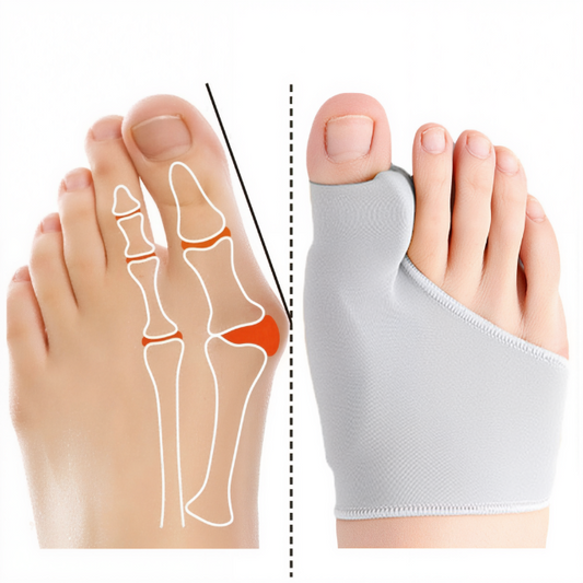 Olvoria | Bunion Corrector Gel Pad Toe Straightener