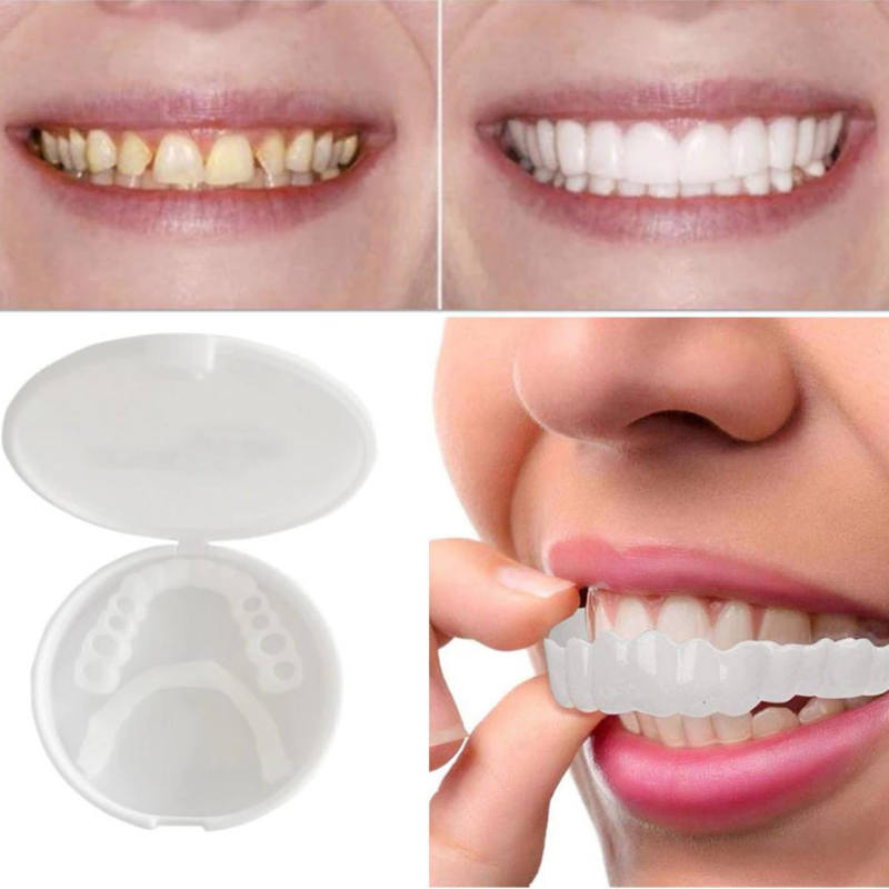 Olvoria | Cosmetic Dental Veneers for Instant Smile Correction