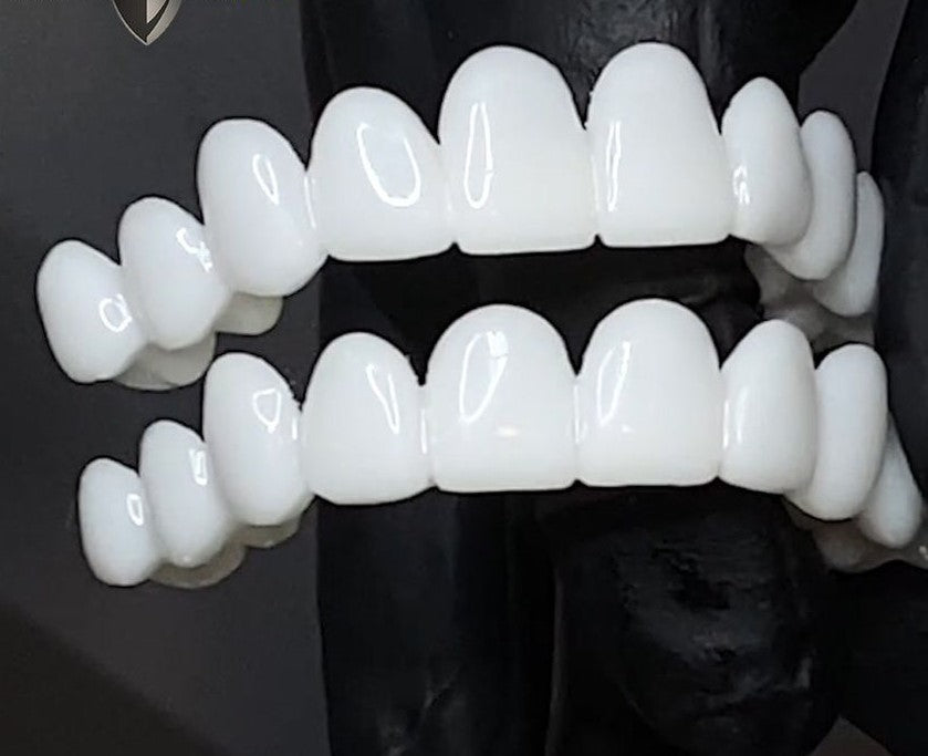 Olvoria | DentAlign Dental Veneers – Natural Fit and Comfort