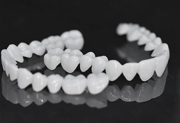 Olvoria | DentAlign Dental Veneers – Natural Fit and Comfort