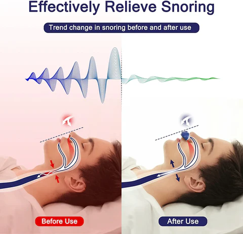 Olvoria | Micro CPAP Sleep Apnea Machine for Travel & Anti-Snoring