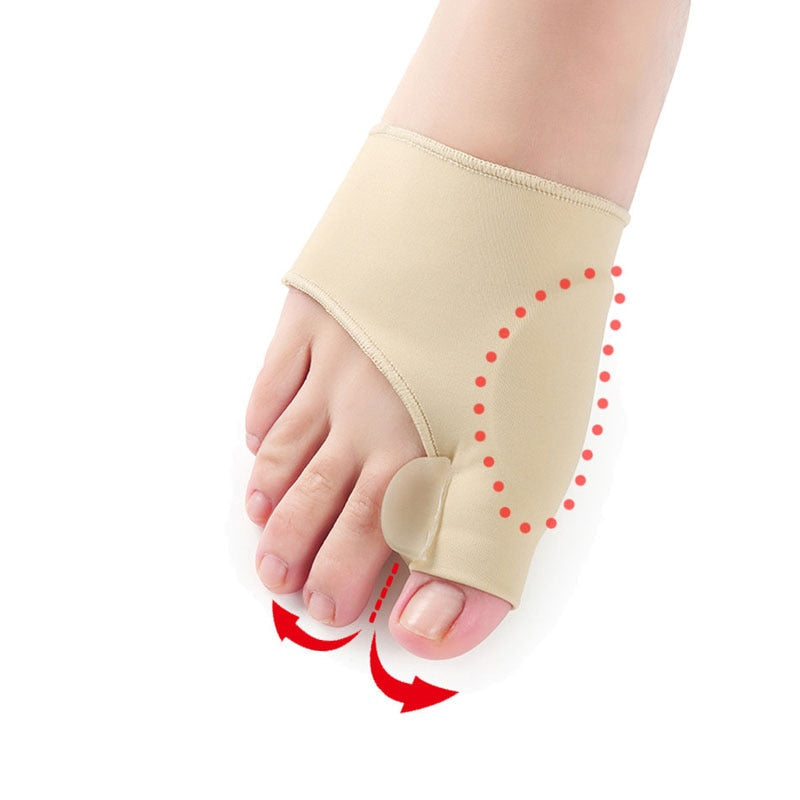 Orthotics for Hallux Valgus