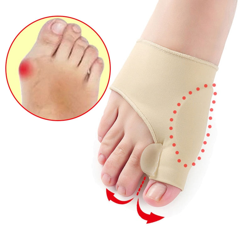 Orthotics for Hallux Valgus