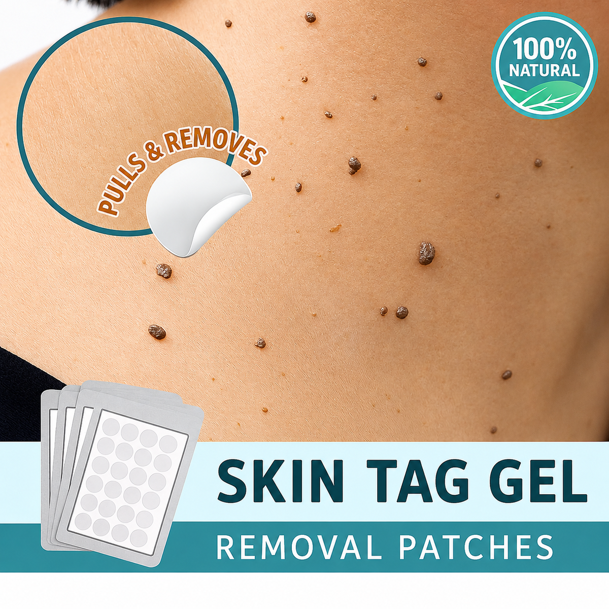 Patchs anti-taches sans douleur et naturels