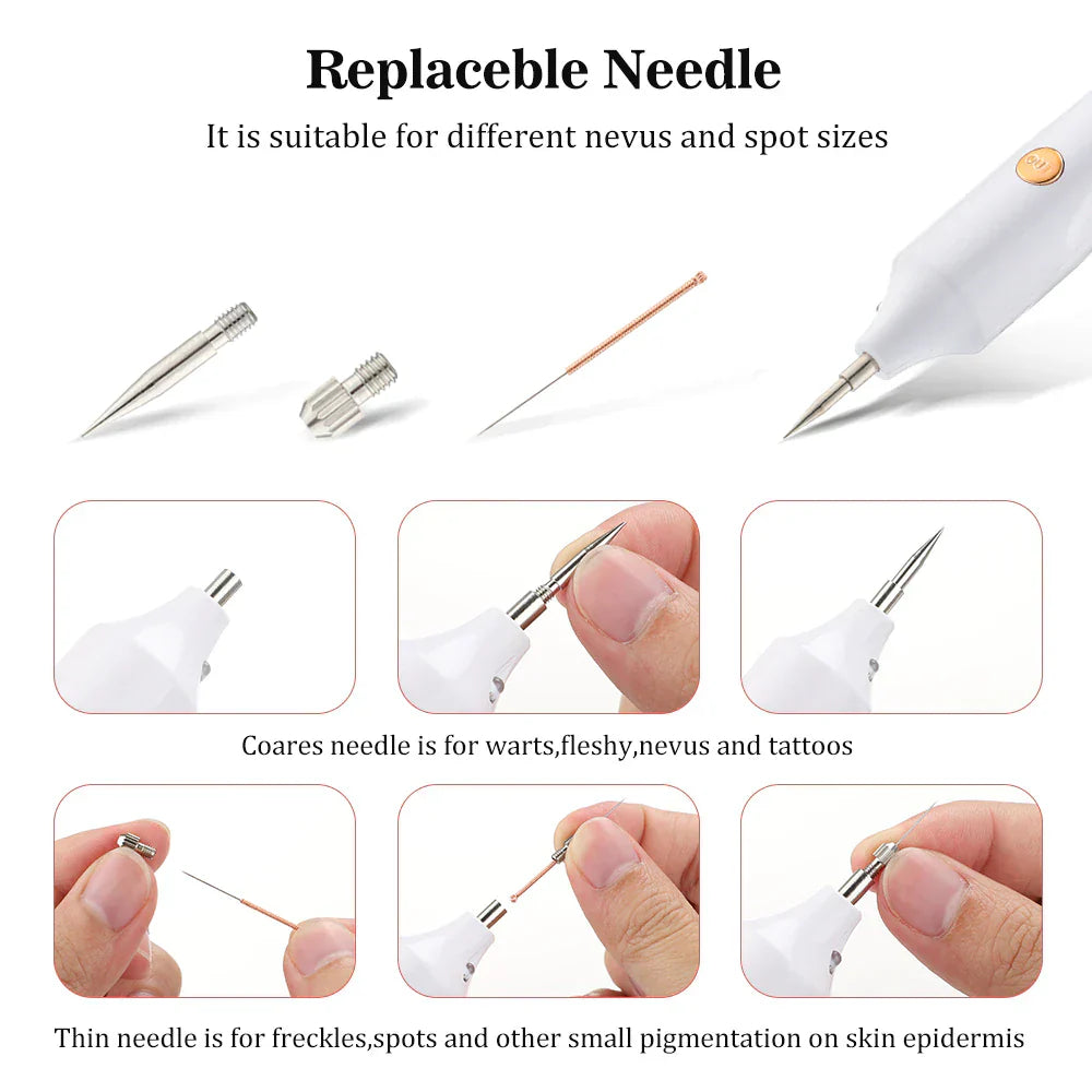 Plasma Pen Skin Tag Remover