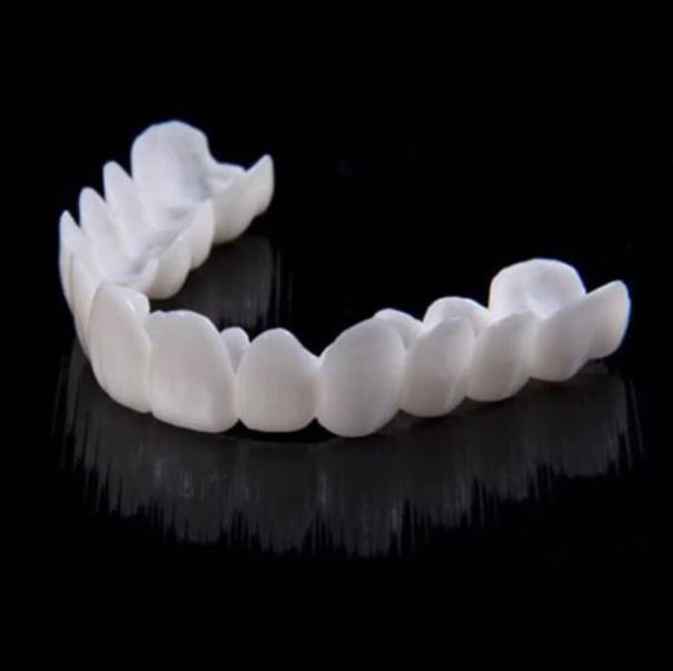 Prothèse dentaire clipsable - Sourire parfait