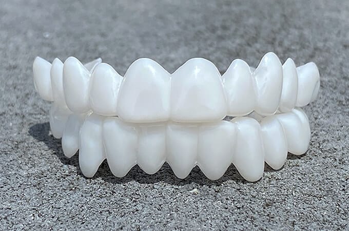 Prothèse dentaire – Restaurez votre sourire instantanément