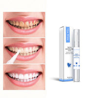 Blanqueamiento dental rápido para una sonrisa radiante