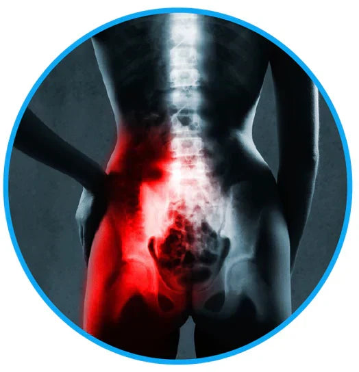 Sciatica Pain Relief Belt - eliminate your sciatica & lower back pain
