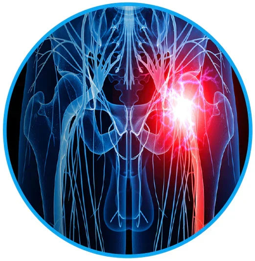 Sciatica Pain Relief Belt - eliminate your sciatica & lower back pain
