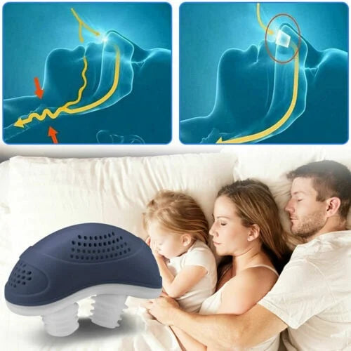 Sleepless, Maskless, Micro-CPAP Anti-Snoring