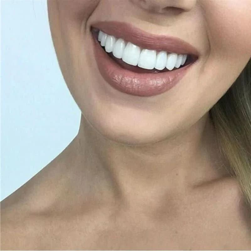 SNAPFIT SMILE – Tooth restoration for a perfect smile without a dentist
