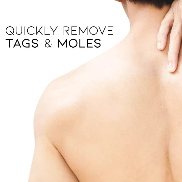 Spray anti-verrues – soin doux et efficace