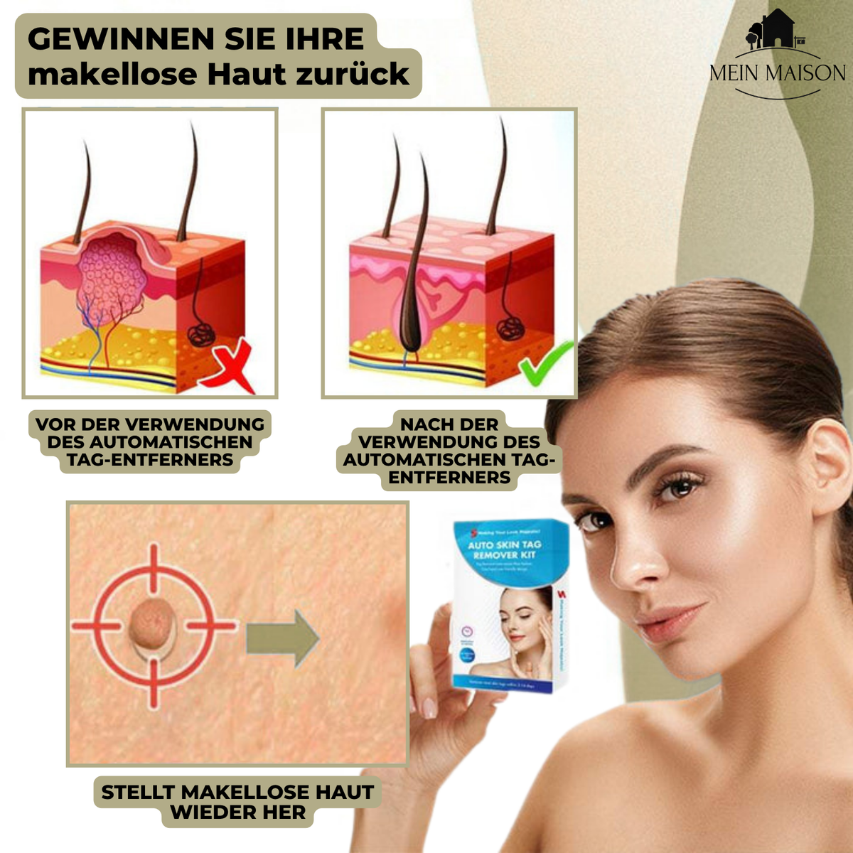 Stylo pour l'élimination des verrues et des grains de beauté sans douleur à domicile