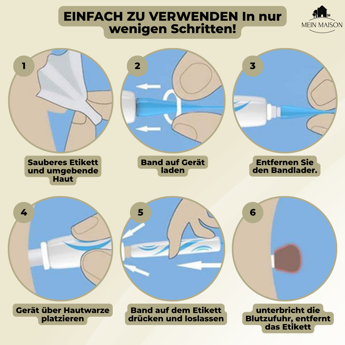 Stylo pour l'élimination des verrues et des grains de beauté sans douleur à domicile